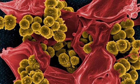Staphylococcus aureus като причина за бактериален простатит